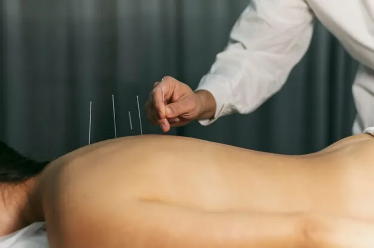 Especialista explica os benefícios da acupuntura no tratamento da ansiedade