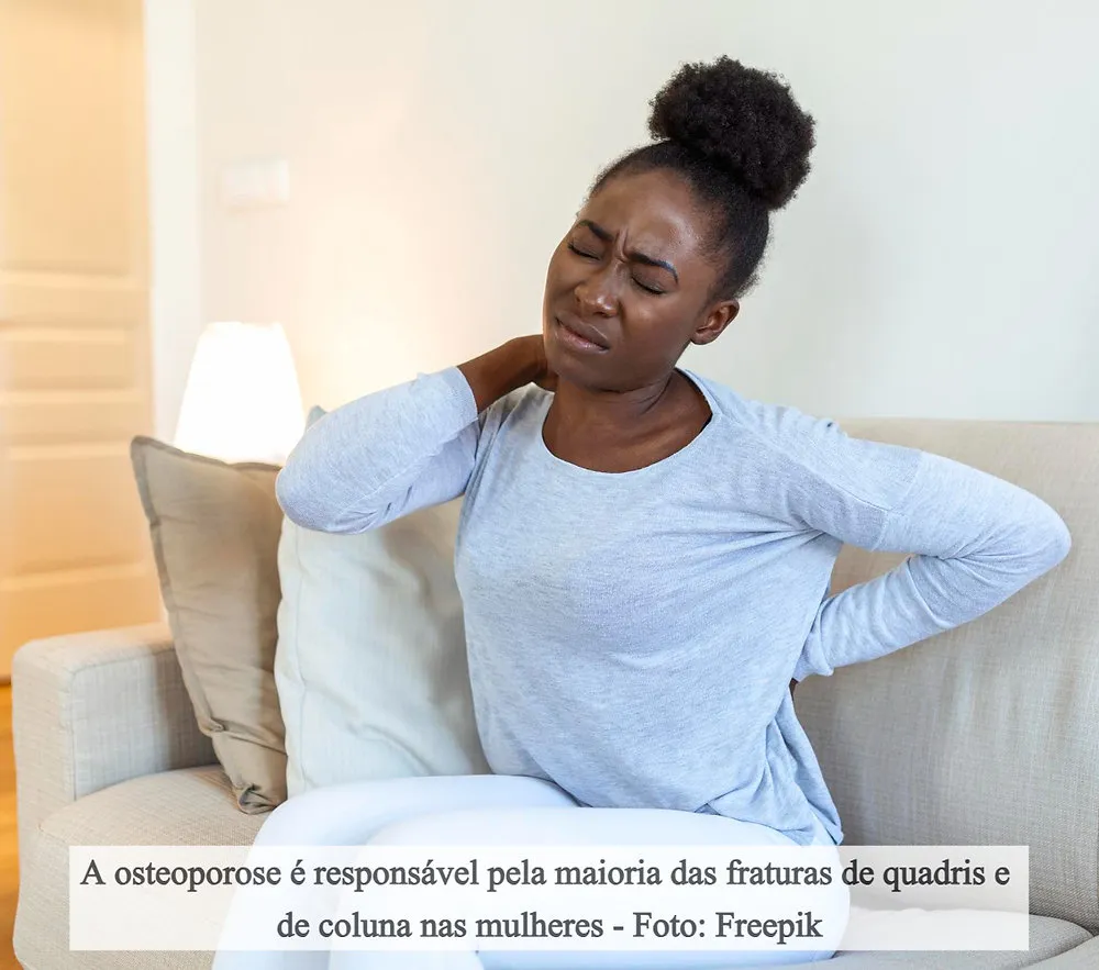 Saúde óssea: mulheres devem iniciar a prevenção à osteoporose aos 40 anos, alerta ortopedista